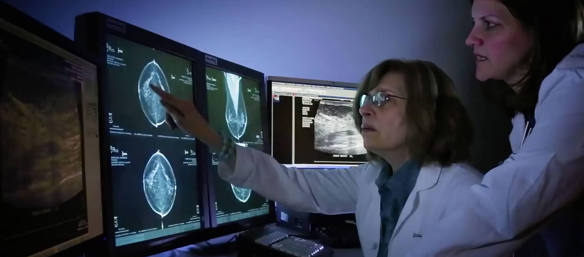 Two female doctors discussing a CAT scan